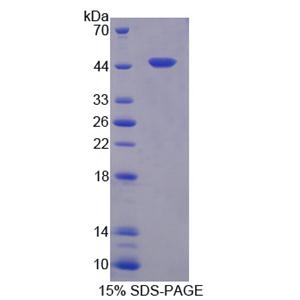 Dickkopf相关蛋白3(DKK3)重组蛋白,Recombinant Dickkopf Related Protein 3 (DKK3)