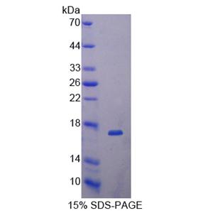 Dickkopf相关蛋白4(DKK4)重组蛋白