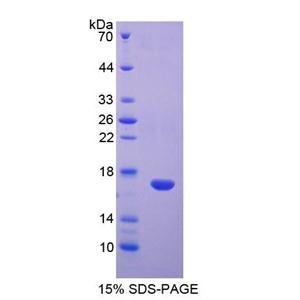 Disabled同源物1(DAB1)重組蛋白,Recombinant Disabled Homolog 1 (DAB1)