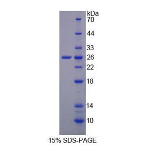 Discs大同源物3(DLG3)重组蛋白