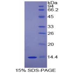 D-多巴色素变位酶(DDT)重组蛋白