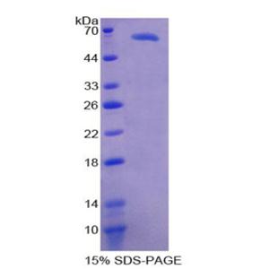 D类清道夫受体1(SCARD1)重组蛋白