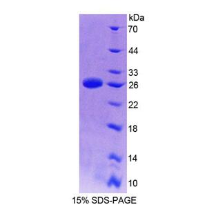 D组着色性干皮病偶联因子(XPD)重组蛋白