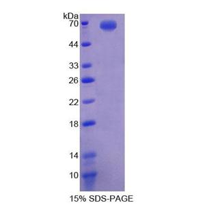 E2F转录因子2(E2F2)重组蛋白,Recombinant E2F Transcription Factor 2 (E2F2)