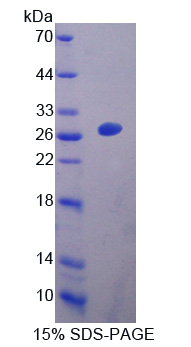 EB病毒诱导蛋白3(EBI3)重组蛋白,Recombinant Epstein Barr Virus Induced Protein 3 (EBI3)