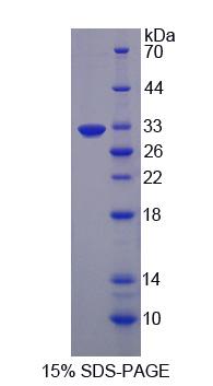 EGF样域蛋白7(EGFL7)重组蛋白,Recombinant EGF Like Domain Protein, Multiple 7 (EGFL7)