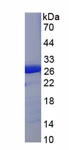 FK506结合蛋白3(FKBP3)重组蛋白,Recombinant FK506 Binding Protein 3 (FKBP3)