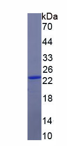 FK506结合蛋白7(FKBP7)重组蛋白,Recombinant FK506 Binding Protein 7 (FKBP7)