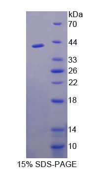 FK506结合蛋白样蛋白(FKBPL)重组蛋白,Recombinant FK506 Binding Protein Like Protein (FKBPL)