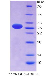 FMS樣酪氨酸激酶3(Flt3)重組蛋白,Recombinant FMS Like Tyrosine Kinase 3 (Flt3)