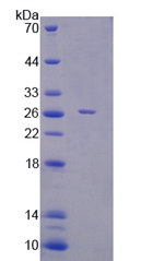 F-框蛋白32(FBXO32)重组蛋白,Recombinant F-Box Protein 32 (FBXO32)