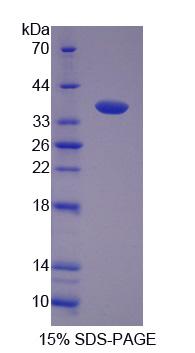 F組著色性干皮病偶聯(lián)因子(XPF)重組蛋白,Recombinant Xeroderma Pigmentosum, Complementation Group F (XPF)