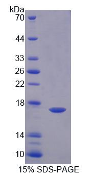 GABA-A受体关联蛋白样蛋白2(GABARAPL2)重组蛋白,Recombinant GABA-A Receptor Associated Protein Like Protein 2 (GABARAPL2)