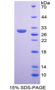 GATA结合蛋白1(GATA1)重组蛋白,Recombinant GATA Binding Protein 1 (GATA1)