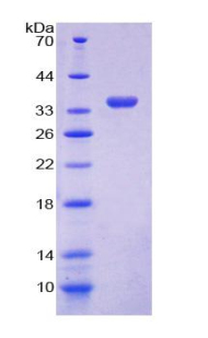 GDP解離抑制因子1(GDI1)重組蛋白,Recombinant GDP Dissociation Inhibitor 1 (GDI1)