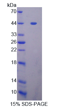 GLI家族锌指蛋白1(GLI1)重组蛋白,Recombinant GLI Family Zinc Finger Protein 1 (GLI1)