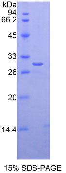 GLI家族锌指蛋白3(GLI3)重组蛋白,Recombinant GLI Family Zinc Finger Protein 3 (GLI3)
