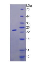 GM2神經(jīng)節(jié)苷脂激活因子(GM2A)重組蛋白,Recombinant GM2 Ganglioside Activator (GM2A)