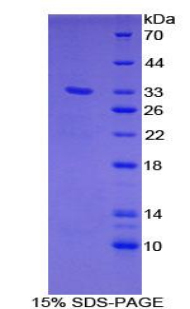 GRB2关联结合蛋白1(GAB1)重组蛋白,Recombinant GRB2 Associated Binding Protein 1 (GAB1)