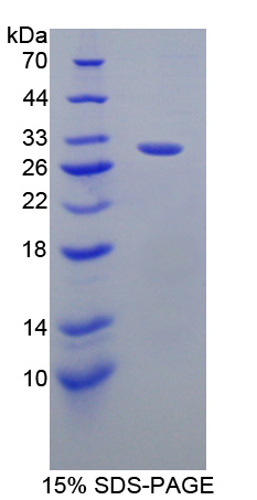 GRB2关联结合蛋白2(GAB2)重组蛋白,Recombinant GRB2 Associated Binding Protein 2 (GAB2)