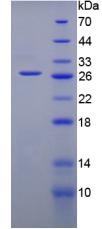 Gremlin 1蛋白(GREM1)重组蛋白,Recombinant Gremlin 1 (GREM1)