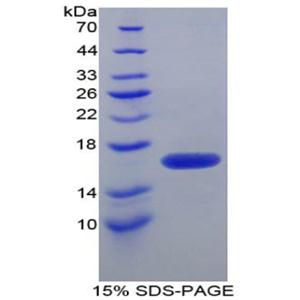 FK506结合蛋白1B(FKBP1B)重组蛋白,Recombinant FK506 Binding Protein 1B (FKBP1B)