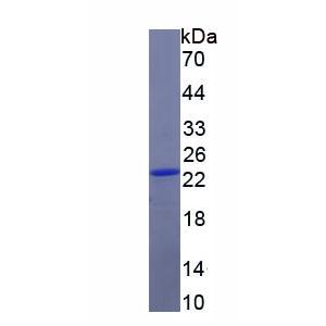 FK506结合蛋白7(FKBP7)重组蛋白,Recombinant FK506 Binding Protein 7 (FKBP7)