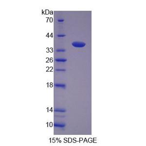 F組著色性干皮病偶聯(lián)因子(XPF)重組蛋白,Recombinant Xeroderma Pigmentosum, Complementation Group F (XPF)