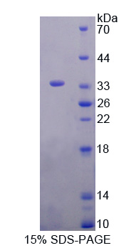 G蛋白偶聯(lián)受體激酶4(GRK4)重組蛋白,Recombinant G Protein Coupled Receptor Kinase 4 (GRK4)