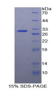 G蛋白偶联受体激酶5(GRK5)重组蛋白,Recombinant G Protein Coupled Receptor Kinase 5 (GRK5)