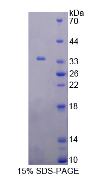 G蛋白偶联受体激酶6(GRK6)重组蛋白,Recombinant G Protein Coupled Receptor Kinase 6 (GRK6)