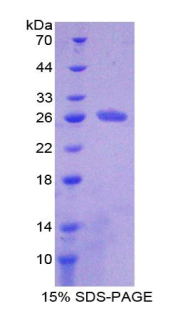 HAUS Augmin样复合体亚基7(HAUS7)重组蛋白,Recombinant HAUS Augmin Like Complex Subunit 7 (HAUS7)