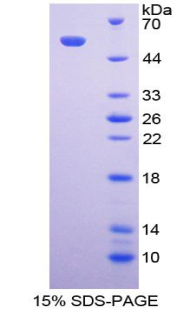 IgA-Fc断片受体(FcaR)重组蛋白,Recombinant Fc Fragment Of IgA Receptor (FcaR)