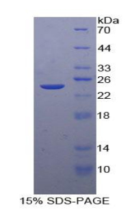 IgG-Fc片段低亲和力受体Ⅲb(FcgR3B)重组蛋白,Recombinant Fc Fragment Of IgG Low Affinity IIIb Receptor (FcgR3B)