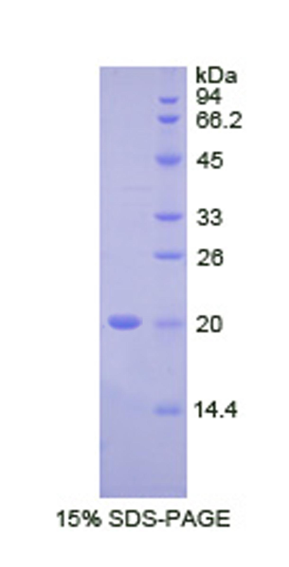 IgG-Fc片段结合蛋白(FcgBP)重组蛋白,Recombinant Fc Fragment Of IgG Binding Protein (FcgBP)