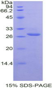 Ig和ITIM域蛋白T-细胞免疫受体(TIGIT)重组蛋白,Recombinant T-Cell Immunoreceptor With Ig And ITIM Domains Protein (TIGIT)