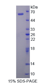 IK細(xì)胞因子(IK)重組蛋白,Recombinant IK Cytokine, Down Regulator Of HLA II (IK)