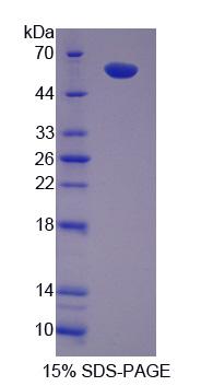 IL2诱导T-细胞激酶(ITK)重组蛋白,Recombinant IL2 Inducible T-Cell Kinase (ITK)