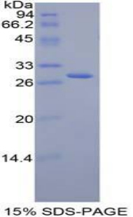 Jagged 2蛋白(JAG2)重组蛋白,Recombinant Jagged 2 Protein (JAG2)