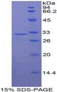 Janus激酶1(JAK1)重組蛋白,Recombinant Janus Kinase 1 (JAK1)