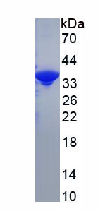 JNK1/MAPK8關(guān)聯(lián)膜蛋白(JKAMP)重組蛋白,Recombinant JNK1/MAPK8 Associated Membrane Protein (JKAMP)