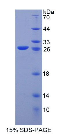 Kell血型糖蛋白(KEL)重組蛋白,Recombinant Kell Protein (KEL)