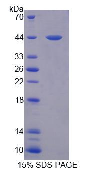 Kruppel样因子15(KLF15)重组蛋白,Recombinant Kruppel Like Factor 15 (KLF15)