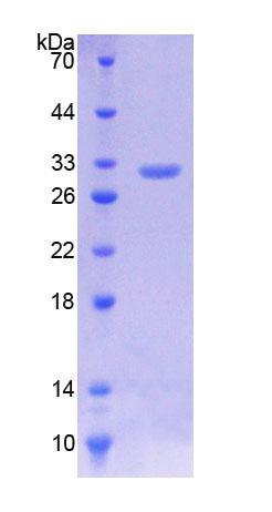 Kruppel樣因子5(KLF5)重組蛋白,Recombinant Kruppel Like Factor 5, Intestinal (KLF5)