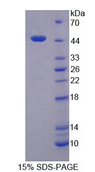 Lemur酪氨酸激酶3(LMTK3)重组蛋白,Recombinant Lemur Tyrosine Kinase 3 (LMTK3)
