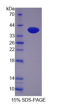 LIM和SH3蛋白1(LASP1)重组蛋白,Recombinant LIM And SH3 Protein 1 (LASP1)