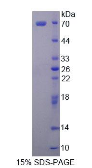 MARCKS相关蛋白(MARCKSL1)重组蛋白,Recombinant MARCKS Related Protein (MARCKSL1)