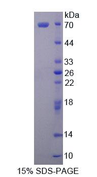 Matrin 3蛋白(MATR3)重组蛋白,Recombinant Matrin 3 (MATR3)