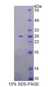 Metaxin 1蛋白(MTX1)重组蛋白,Recombinant Metaxin 1 (MTX1)