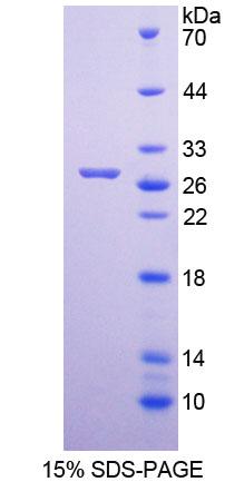 MutY同源物(MUTYH)重组蛋白,Recombinant MutY Homolog (MUTYH)